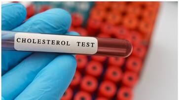 High Cholesterol Test.. Important Things You Should Keep In Mind.. Rya High Cholesterol Test.. Important Things You Should Keep In Mind.. Rya