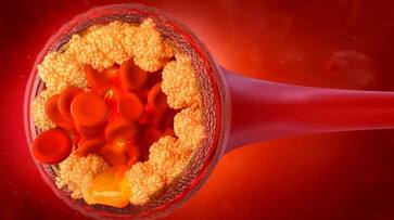 four vegetables to lower cholesterol levels azn four vegetables to lower cholesterol levels azn