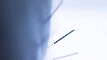 two year old swallowed eight needles rlp two year old swallowed eight needles rlp