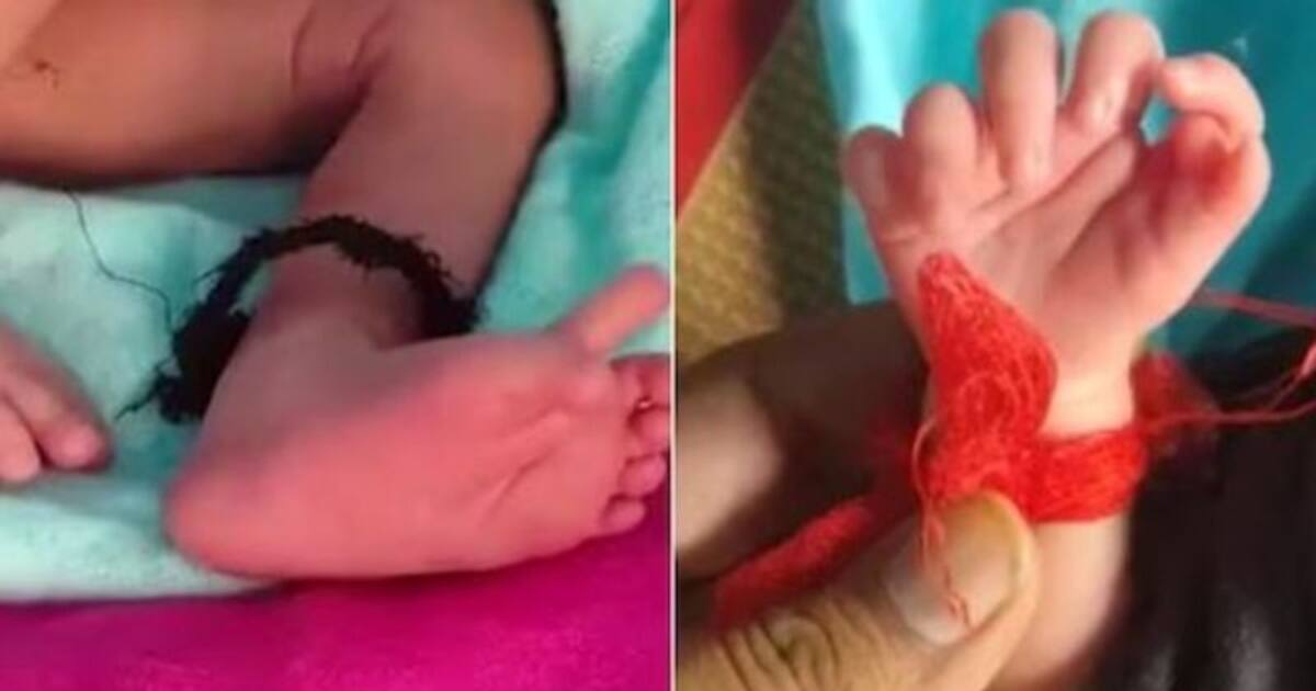 26 விரல்களுடன் பிறந்த பெண் குழந்தை.. லக்ஷ்மி தேவியின் அவதாரம் என குடும்பத்தினர் மகிழ்ச்சி..