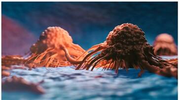 five reasons behind lung cancer in non smokers-rse- five reasons behind lung cancer in non smokers-rse-