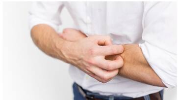 fatty liver disease symptoms on face and skin-rse- fatty liver disease symptoms on face and skin-rse-