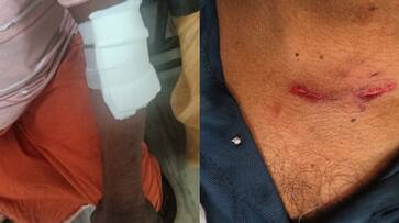 stray dog attack in mannar; 3 persons injured stray dog attack in mannar; 3 persons injured
