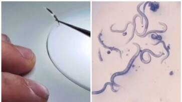 Do you bite your nails when you are stressed then watch this video bkg Do you bite your nails when you are stressed then watch this video bkg