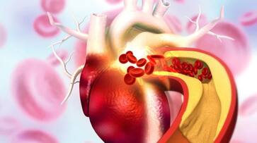 How Stress can affect your Cholesterol Levels azn How Stress can affect your Cholesterol Levels azn
