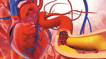 World Heart Day 2023 things to lower bad cholesterol azn World Heart Day 2023 things to lower bad cholesterol azn