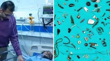 doctors removed earphones and metal waste from mans stomach hyp doctors removed earphones and metal waste from mans stomach hyp