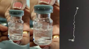 15 centimeter long worm found in 39 year old womens eye in aluva kochi etj 15 centimeter long worm found in 39 year old womens eye in aluva kochi etj