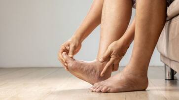 symptoms of gout and tips to control uric acid azn symptoms of gout and tips to control uric acid azn