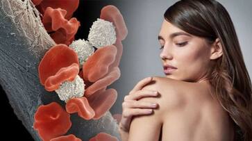 10 early signs of blood cancer azn 10 early signs of blood cancer azn