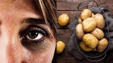 how potato helps in removing dark circles azn how potato helps in removing dark circles azn