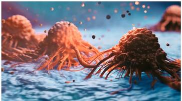 what are the symptoms of prostate cancer-rse- what are the symptoms of prostate cancer-rse-