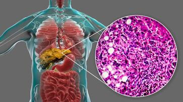superfoods to keep your liver-healthy-rse- superfoods to keep your liver-healthy-rse-