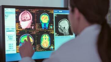 study says that covid 19 can affect brain function and may lead to death hyp study says that covid 19 can affect brain function and may lead to death hyp