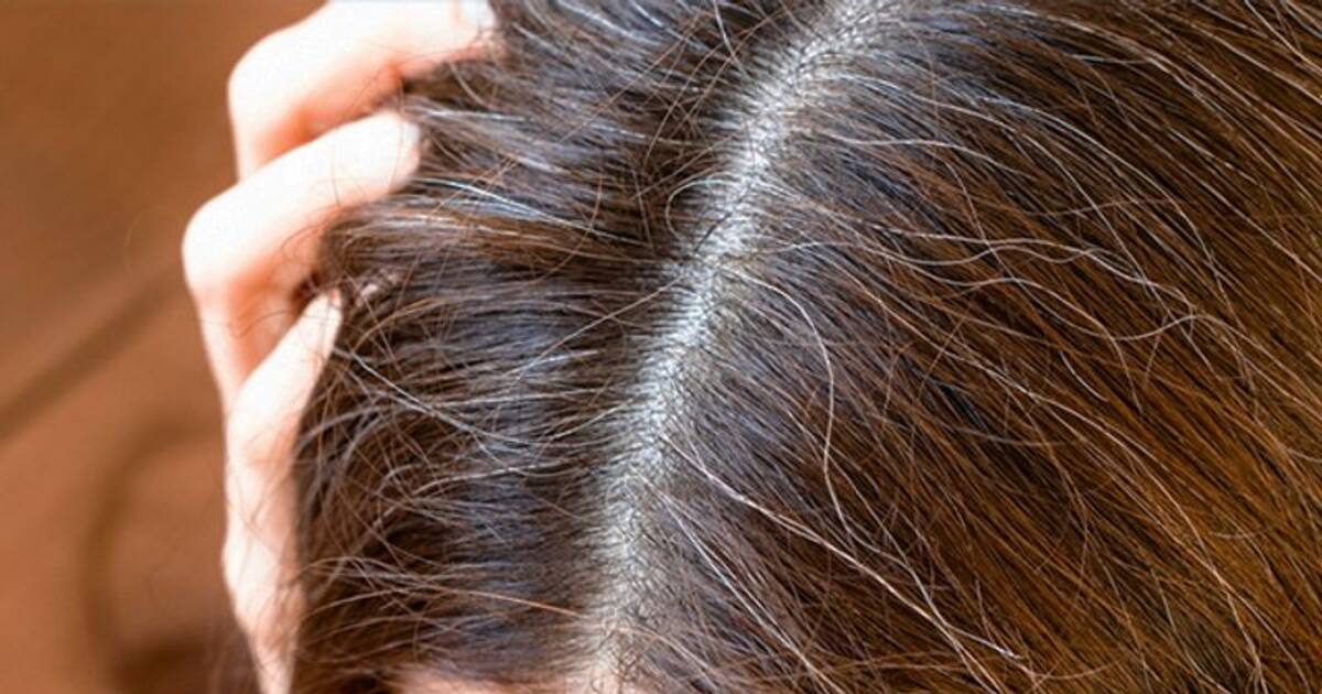 White hair vitamin b12 deficiency causes grey hair rsl