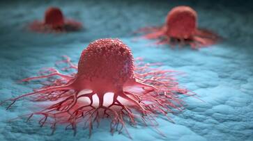 cancer symptoms that should not be ignored cancer symptoms that should not be ignored