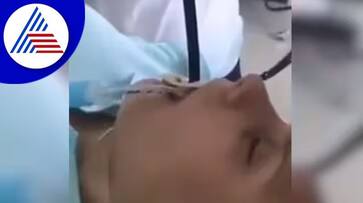 Snake Crawled Into Woman Mouth In Russia Viral Video roo Snake Crawled Into Woman Mouth In Russia Viral Video roo