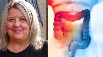 Medical Miracle Woman from wales suffering from stage 3 colorectal cancer is completely cured by Dostarlimab Injection akb Medical Miracle Woman from wales suffering from stage 3 colorectal cancer is completely cured by Dostarlimab Injection akb