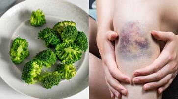foods rich in vitamin k azn foods rich in vitamin k azn