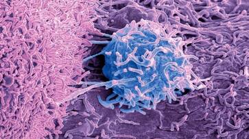 sulphur rich foods that reduce cancer risk azn sulphur rich foods that reduce cancer risk azn