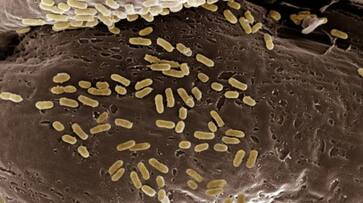 things to do for preventing food poisoning hyp things to do for preventing food poisoning hyp