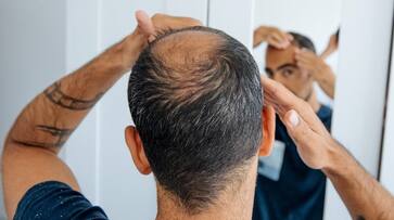 can wearing a hat cause hair fall know the exact reason behind it in tamil mks can wearing a hat cause hair fall know the exact reason behind it in tamil mks