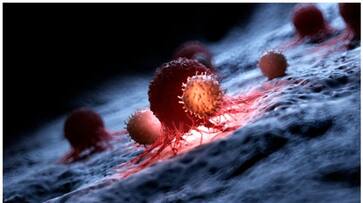 cancer symptoms you shouldnt ignore-rse- cancer symptoms you shouldnt ignore-rse-