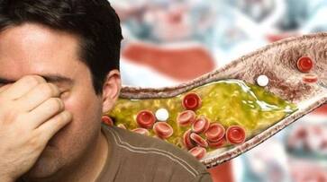 cholesterol symptoms in eyes and ears you must aware cholesterol symptoms in eyes and ears you must aware