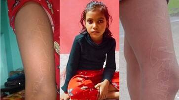 uttar pradesh hardoi girl Sakshi stomach has ram Radhe hindi words doctors surprised Viral Video san uttar pradesh hardoi girl Sakshi stomach has ram Radhe hindi words doctors surprised Viral Video san