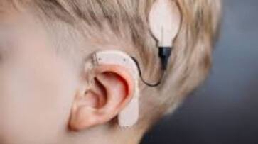 15 people underwent cochlear implantation surgeries all free of charge ppp 15 people underwent cochlear implantation surgeries all free of charge ppp