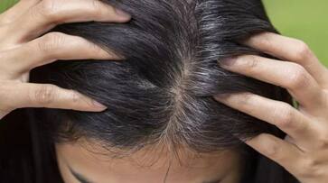 nuts to prevent premature greying of hair nuts to prevent premature greying of hair