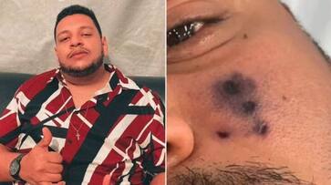 brazilian singer darlyn moraise died after spiders bite brazilian singer darlyn moraise died after spiders bite