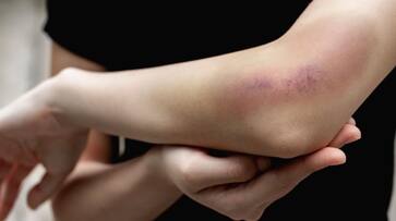 warning symptoms of vitamin k deficiency warning symptoms of vitamin k deficiency