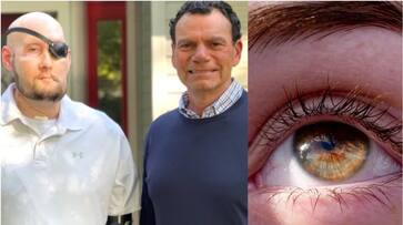 NYU Surgeons performed the first ever whole eye transplant in a human prm NYU Surgeons performed the first ever whole eye transplant in a human prm