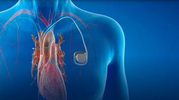 Uttar Pradesh Police arrested a cardiologist who implanted poor quality pacemakers in around 600 people from 2017 to 2021 in that 200 patients are died akb Uttar Pradesh Police arrested a cardiologist who implanted poor quality pacemakers in around 600 people from 2017 to 2021 in that 200 patients are died akb