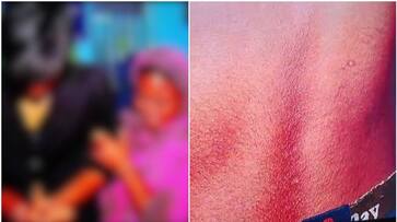 police beaten up 14 year-old boy in Alappuzha nbu police beaten up 14 year-old boy in Alappuzha nbu