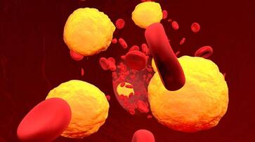 foods that naturally reduces high cholesterol foods that naturally reduces high cholesterol