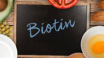 biotin rich foods for hair and skin health biotin rich foods for hair and skin health