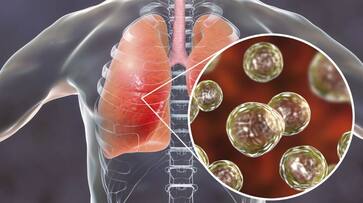 what is fungal pneumonia and symptoms what is fungal pneumonia and symptoms
