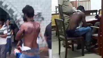 'Pujapura Jail prisoner was abused by pouring hot water on his body'; The court sought the report 'Pujapura Jail prisoner was abused by pouring hot water on his body'; The court sought the report