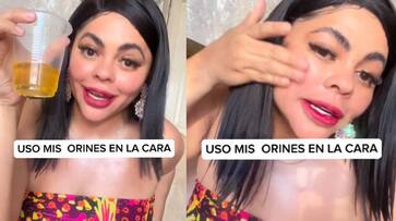 Colombian singer and influencer koral costa says she is using urine for face rlp Colombian singer and influencer koral costa says she is using urine for face rlp