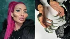 Woman with 'world's largest cheeks' unveils 'witch-like' nail transformation; draws mixed reactions (WATCH) snt