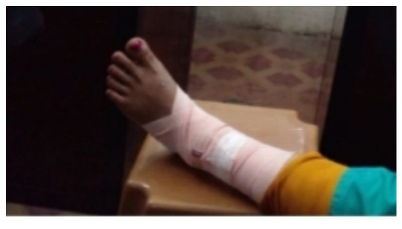 Woman injured after leg trapped in slab prm 