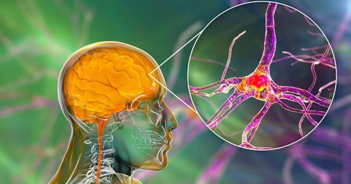 What is Trigeminal Neuralgia? Know its symptoms, causes, diagnosis