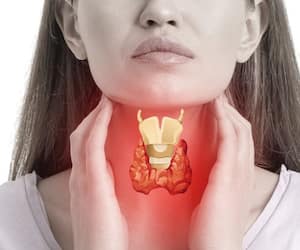 How to control thyroid without medicine rsl