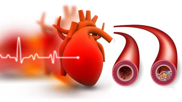 Athletes Heart Rate: Will athletes have the same heart rate as normal humans? KRJ