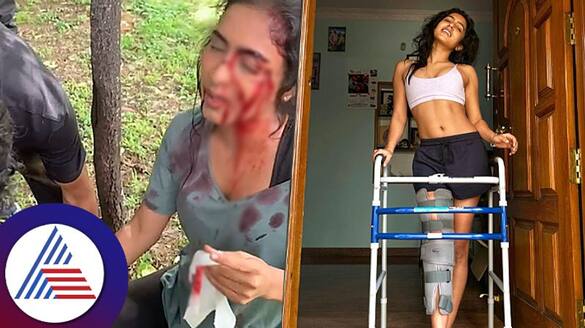 Actress Samyuktha Hegde leg injured during kreem movie shooting srb