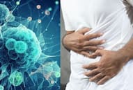 What are the causes and symptoms of stomach cancer Early diagnosis can help with the cure iwh
