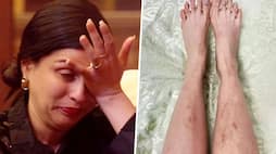 Bigg Boss 17 contestant Mannara Chopra shows bruises from 'mirchi task', says 'slowly fading' RBA