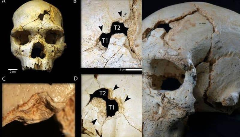 known first murder in the world is 430000 years old rlp